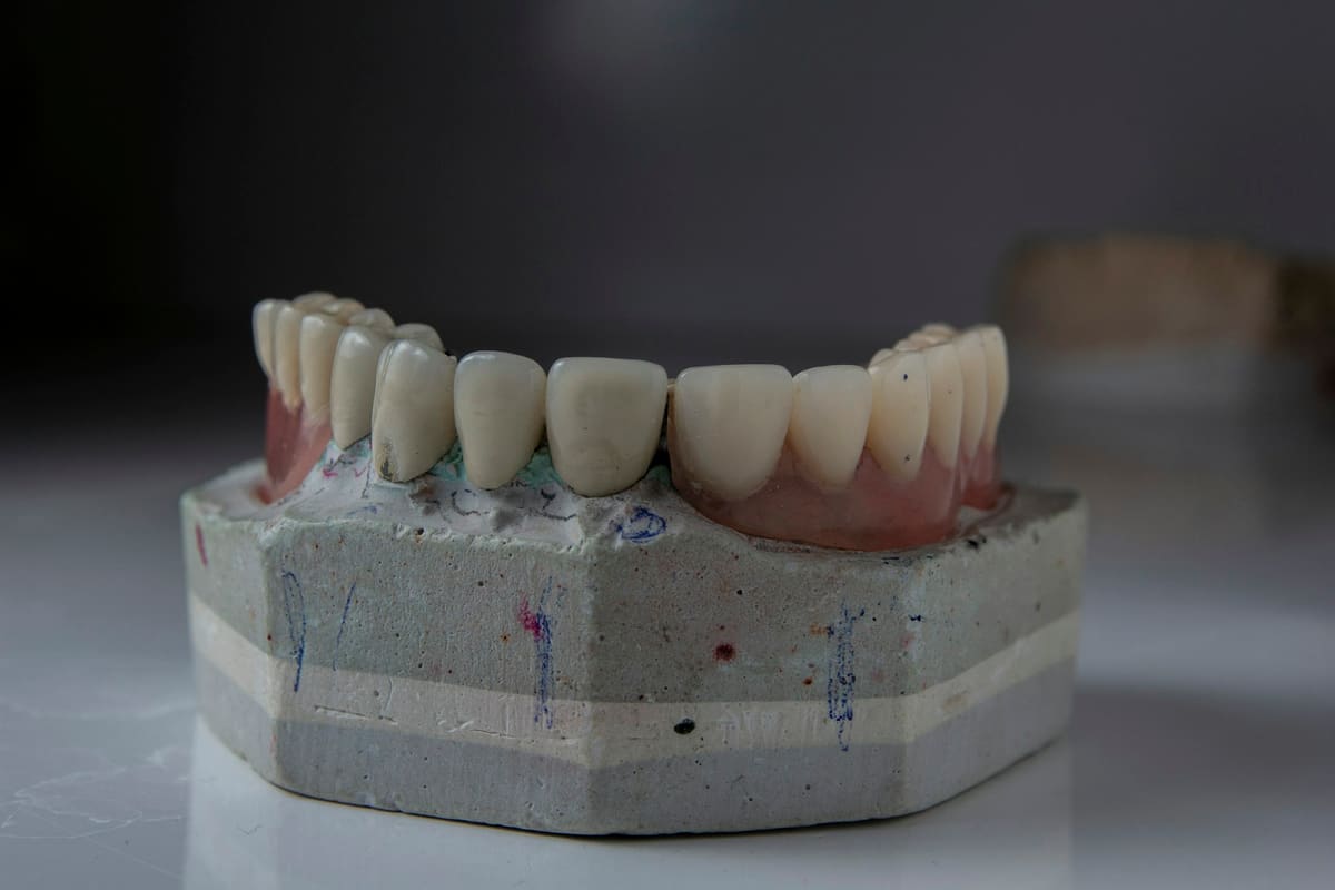 Dental model showing a full row of restored teeth